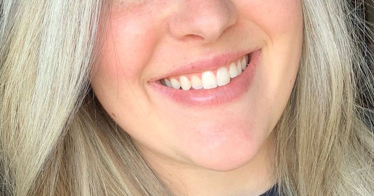 Allyson Counts Tech from Glade Spring, VA Vetster